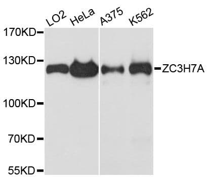 ZC3H7A Antibody