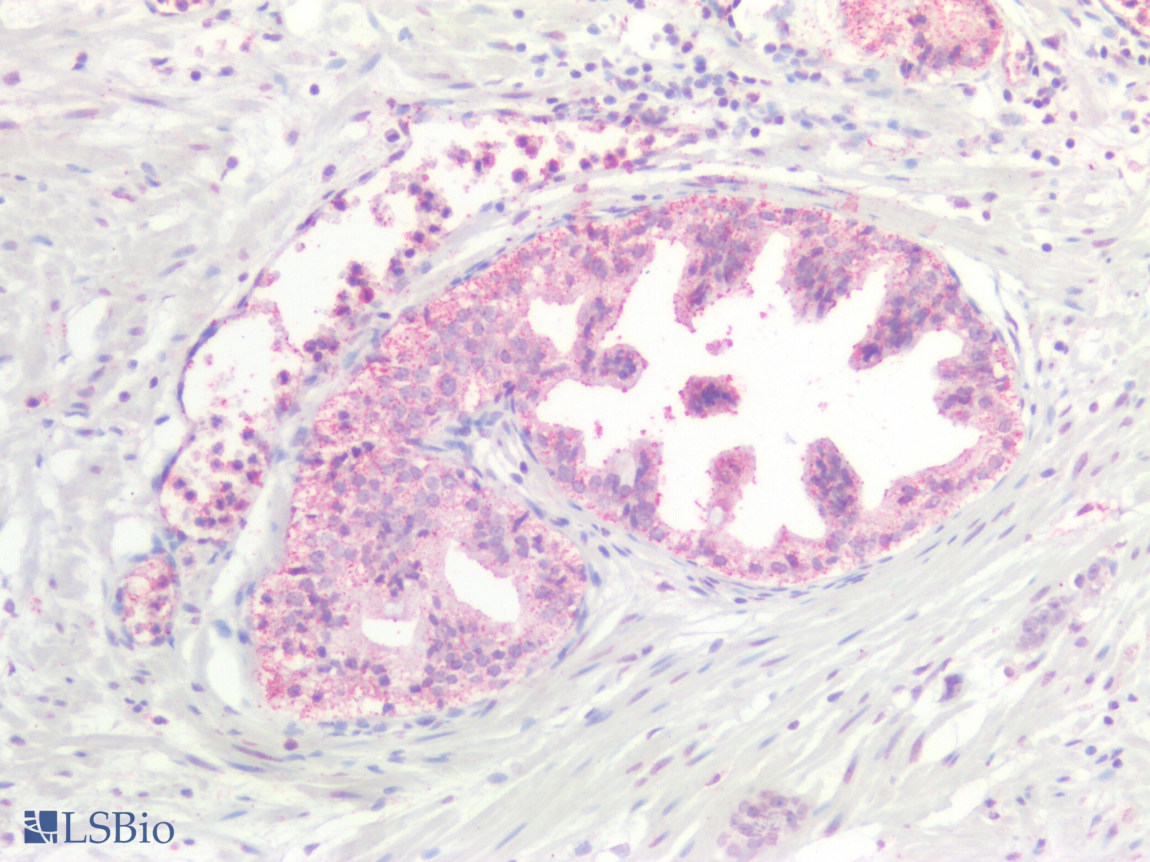 IHC-plus™ KRAS Antibody