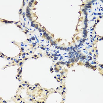 ARSF / Arylsulfatase F Antibody