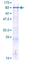 Human ACSBG2 Protein (Recombinant GST)
