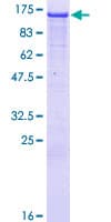 Human NEDD4L / NEDD4-2 Protein (Recombinant GST)