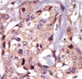 TEC Antibody (aa175-205)