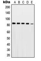 Polyclonal Rabbit anti-Human PRKCG / PKC-Gamma Antibody (Internal, WB)
