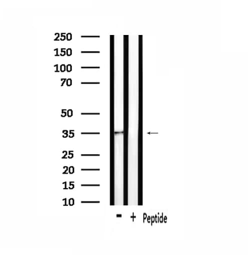 OR4F21 Antibody