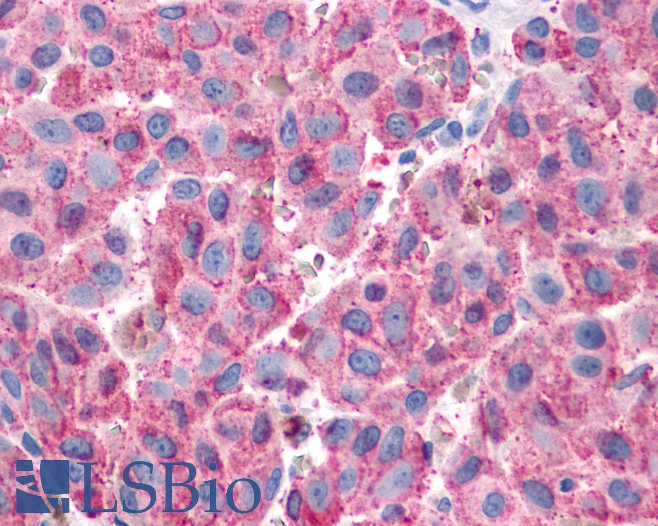 IHC-plus™ Polyclonal Rabbit anti-Human NPY1R Antibody (Cytoplasmic Domain, IHC)