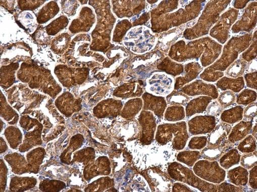 GRIP1 Antibody (aa89-1076)