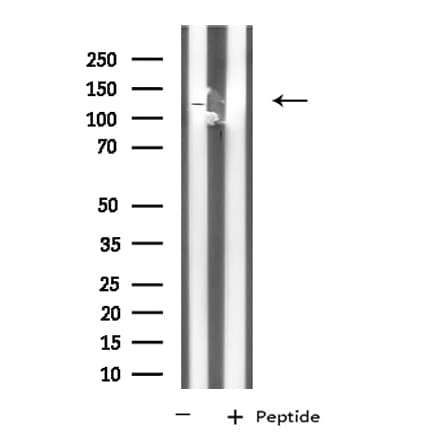 KCNH3 / Kv12.2 Antibody