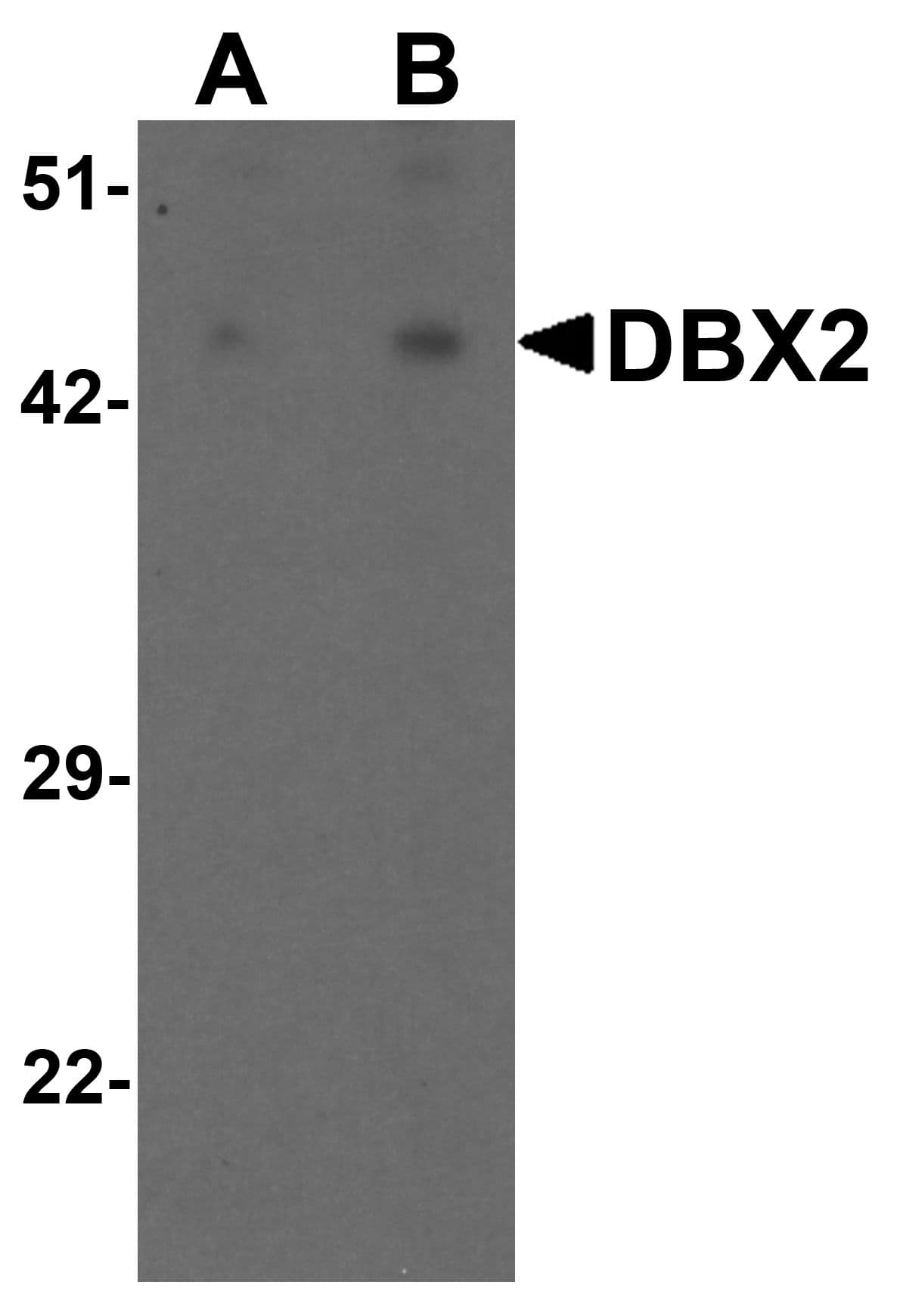IHC-plus™ DBX2 Antibody
