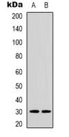ACBD6 Antibody (Internal)