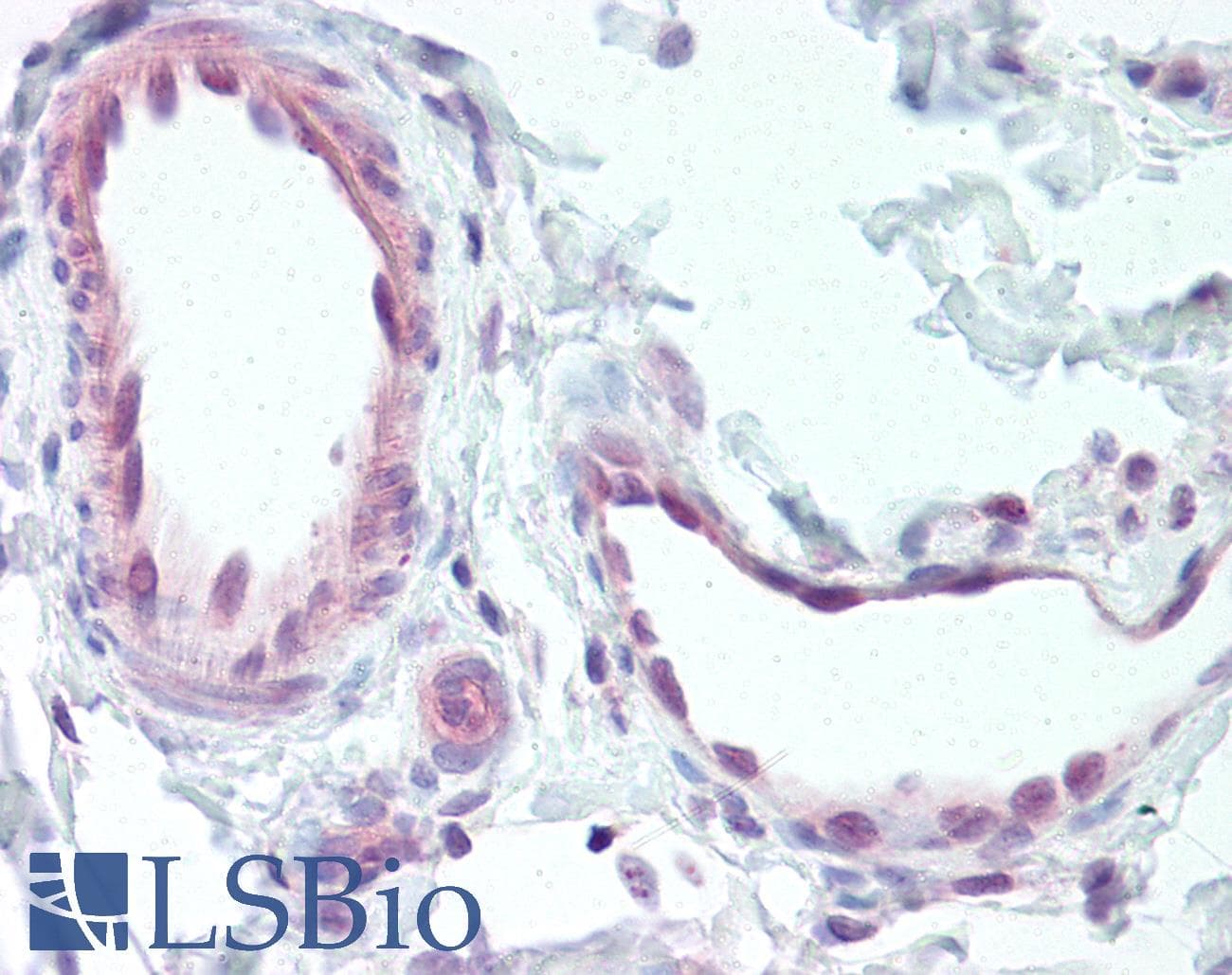 IHC-plus™ EDNRB / Endothelin B Receptor Antibody (C-Terminus)