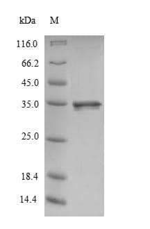 Rat CALM1 / Calmodulin Protein (Recombinant 6His-SUMO, N-terminus + Myc, C-terminus)