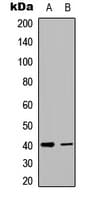 Polyclonal Rabbit anti-Human CD30L / CD153 Antibody (Internal, WB)