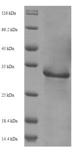 Human Immunodeficiency Virus 2 vpx Protein (Recombinant 6His-SUMO, N-terminus)