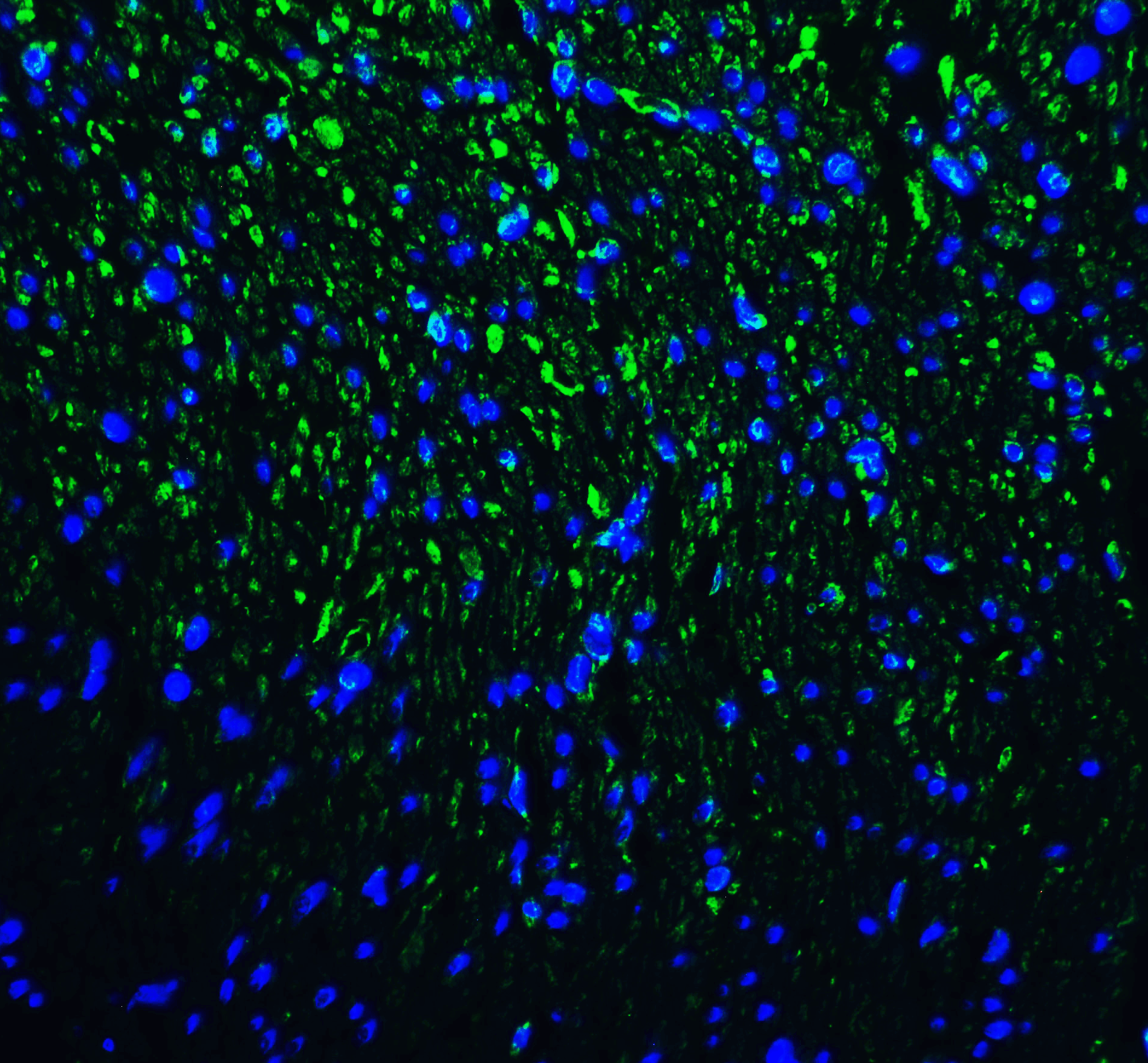 HAVCR2 / TIM-3 Antibody (clone 9G1)