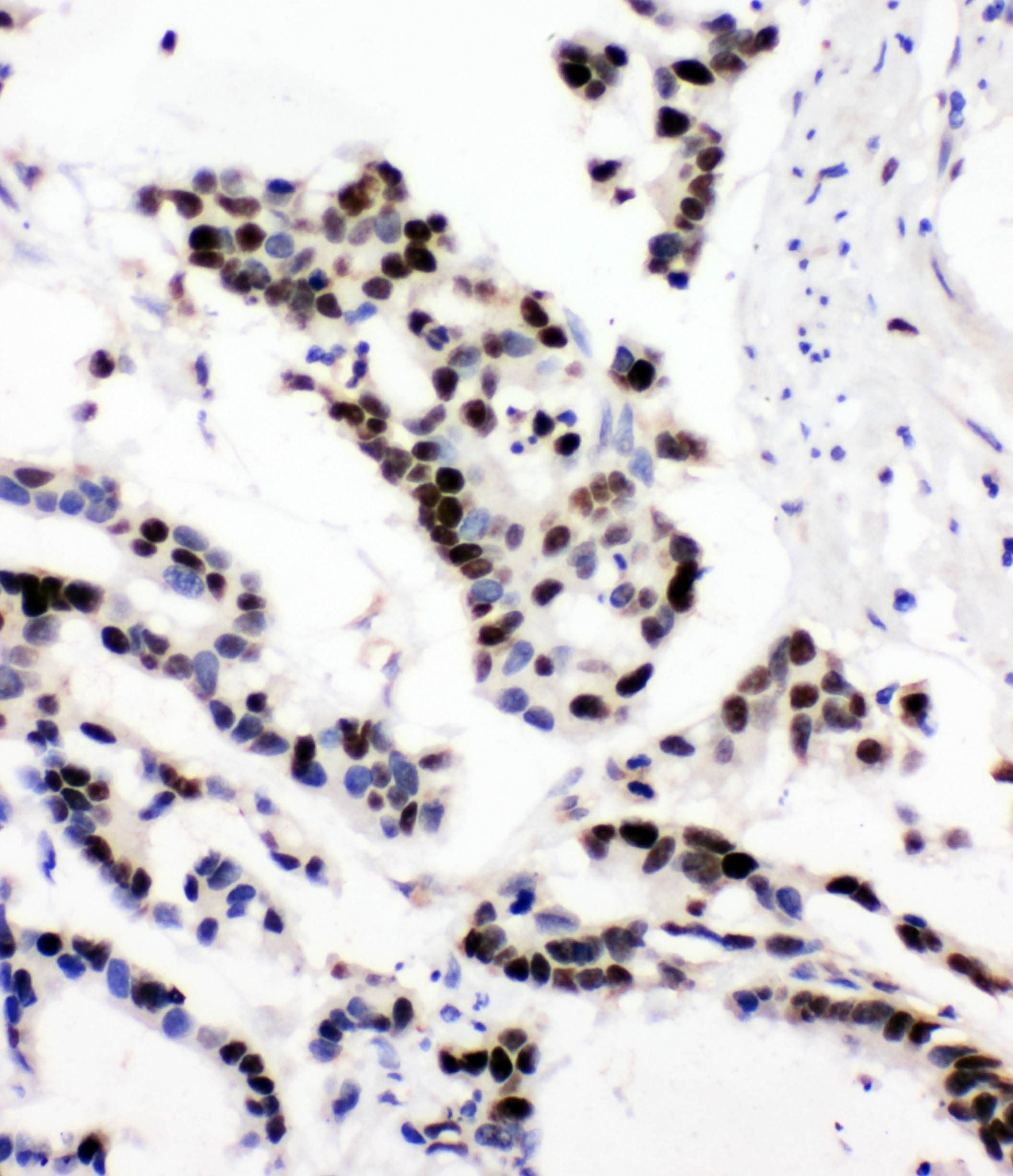 Polyclonal Rabbit anti-Human MCM6 Antibody (aa589-605, IHC, WB)