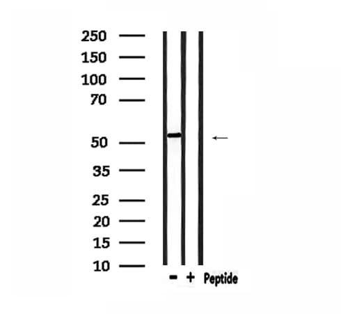 PRKACB Antibody