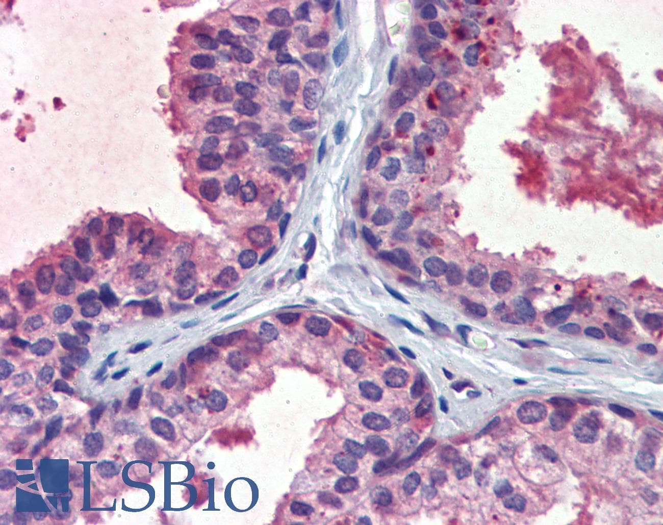 IHC-plus™ EPHB2 / EPH Receptor B2 Antibody (aa17-200, clone 2D12C6)