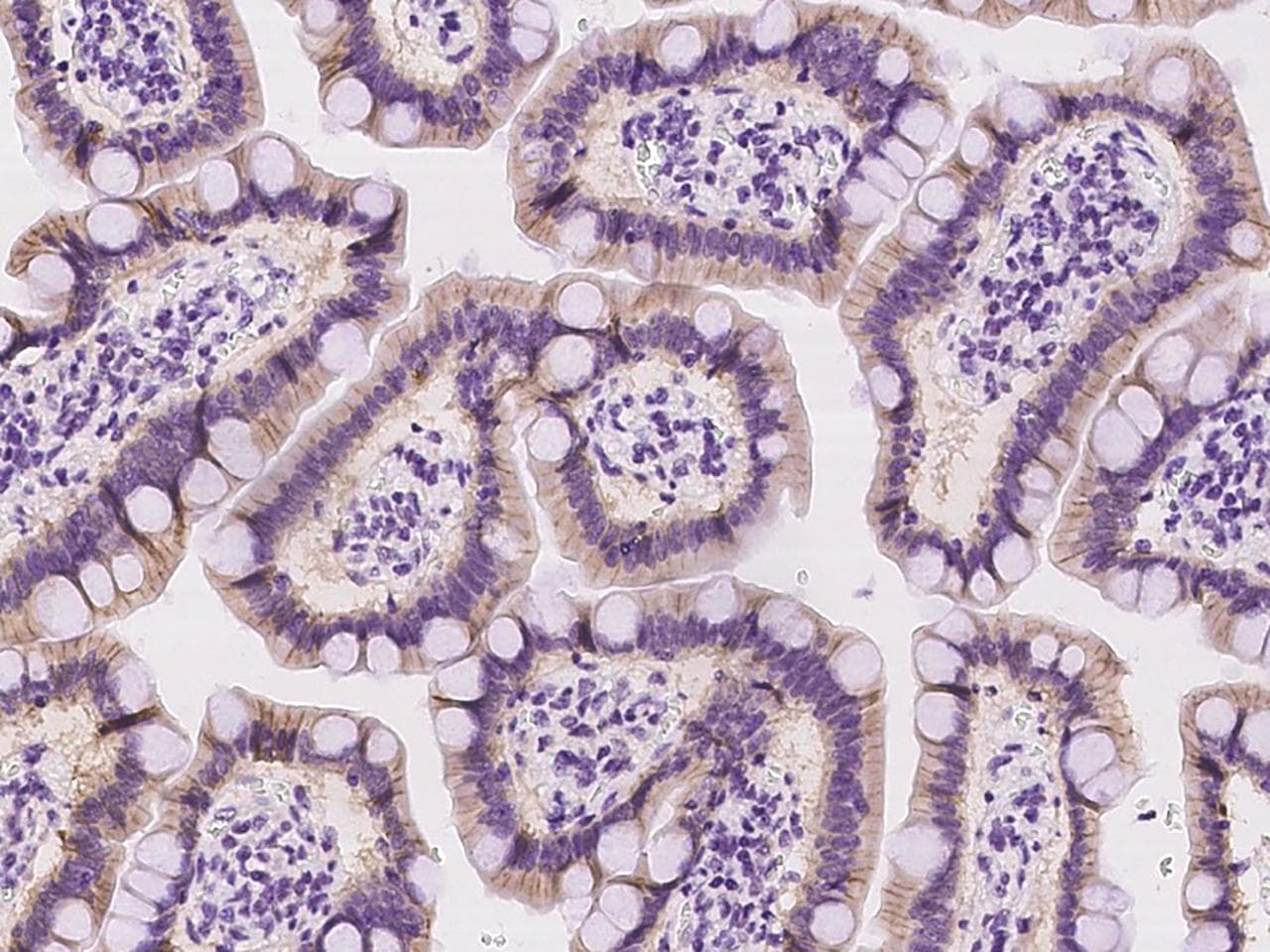 TMIGD2 Antibody