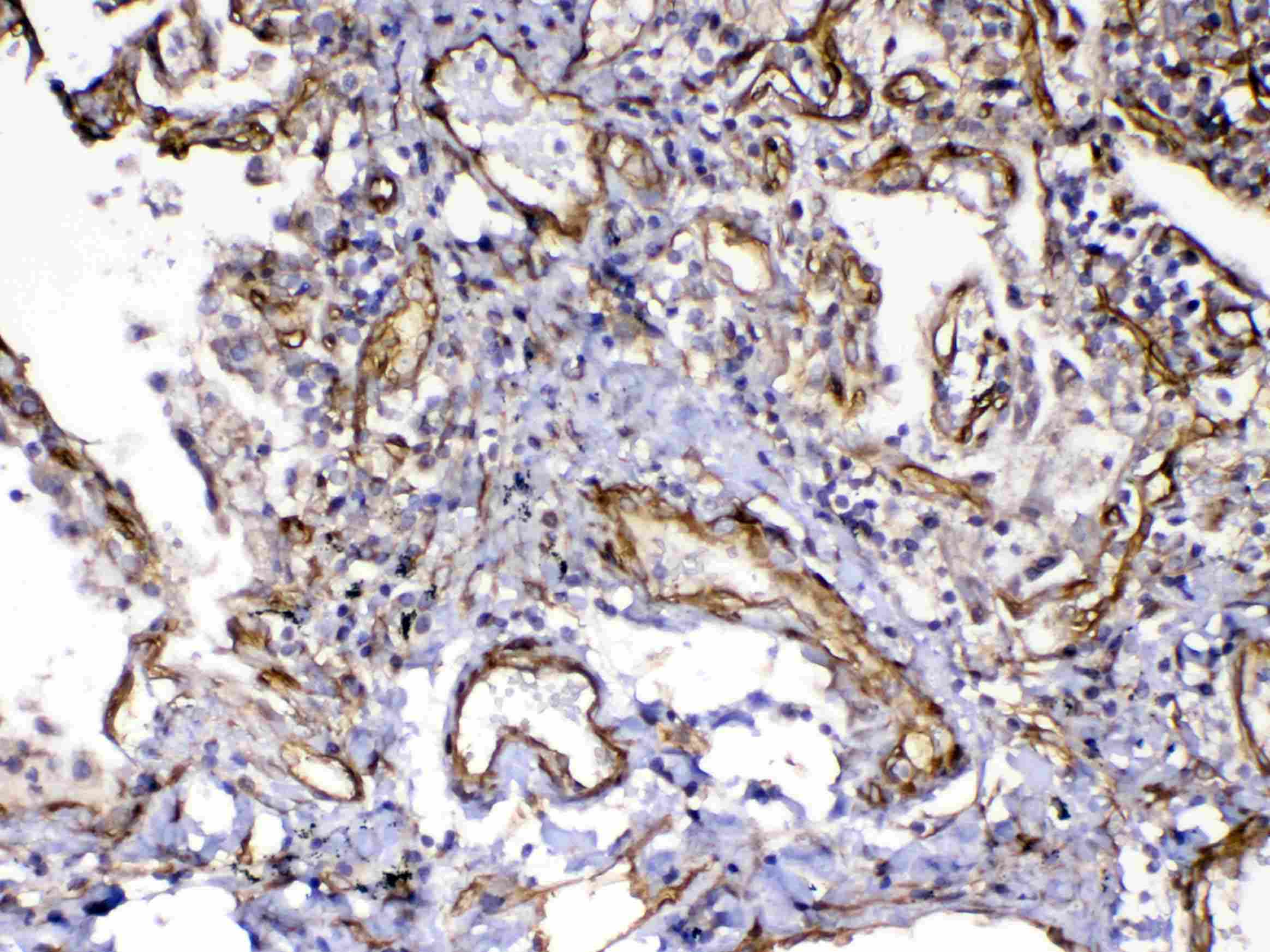 Polyclonal Rabbit anti-Human FLT4 / VEGFR3 Antibody (IHC, WB)