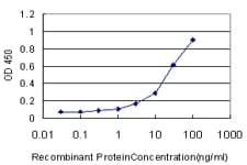 IHC-plus™ Monoclonal Mouse anti-Human BBOX1 / BBOX Antibody (clone 6H3, IHC, WB)
