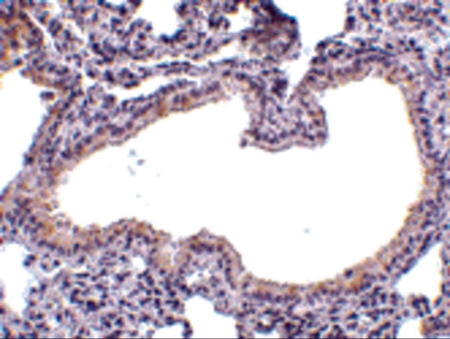 Polyclonal Rabbit anti-Human SLPI / Antileukoproteinase Antibody (IHC, WB)