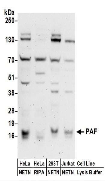 PCNA-Associated Factor Antibody (aa61-111)