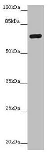 Polyclonal Rabbit anti-Human ZNF20 Antibody (WB)