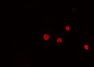 Polyclonal Rabbit anti-Human NKX2-4 Antibody (IF, WB)