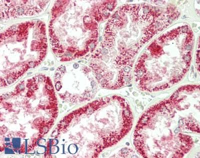 IHC-plus™ Polyclonal Rabbit anti-Human ENTPD5 / CD39L4 Antibody (aa333-362, IHC, WB)