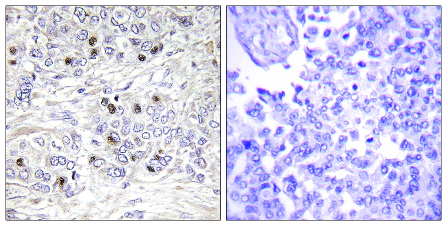 Polyclonal Rabbit anti-Human TEAD2 Antibody (aa71-120, IHC, IF)