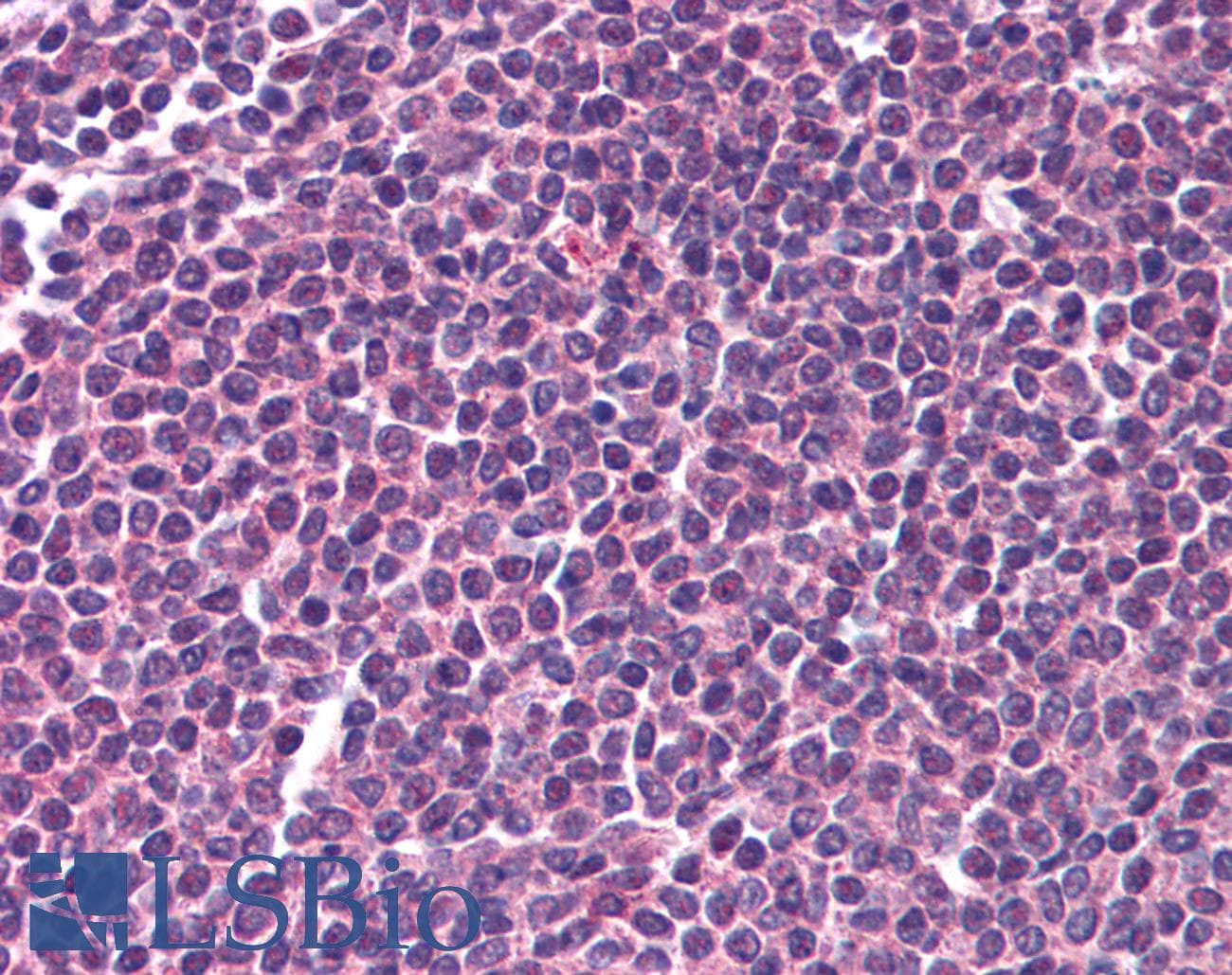 IHC-plus™ RELA / NFKB p65 Antibody (C-Terminus)