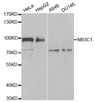 IHC-plus™ Polyclonal Rabbit anti-Human NR3C1/Glucocorticoid Receptor Antibody (IHC, IF, WB)