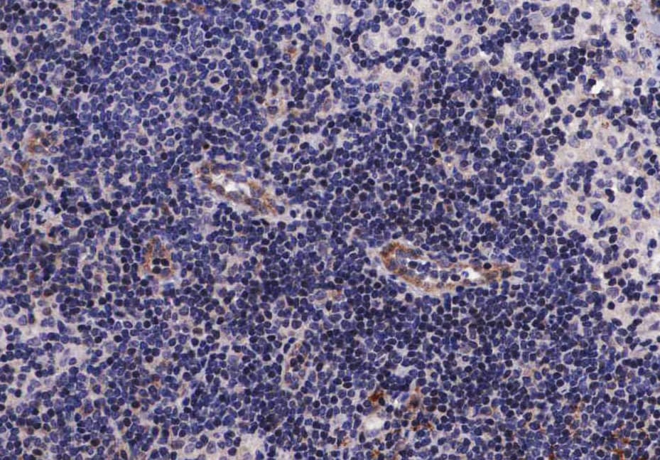EGFR Antibody (phospho-Ser1070)