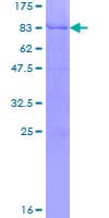 Human LPL / Lipoprotein Lipase (Recombinant GST)