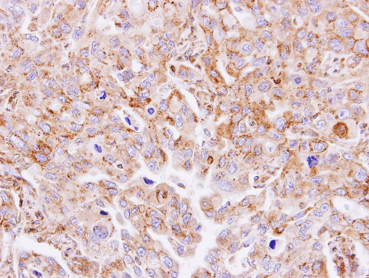 GNT-III / MGAT3 Antibody (aa260-525)