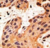 GJA8 / CX50 / Connexin 50 Antibody (aa402-433)