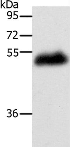 Polyclonal Rabbit anti-Human LOX / Lysyl Oxidase Antibody (IHC, WB)