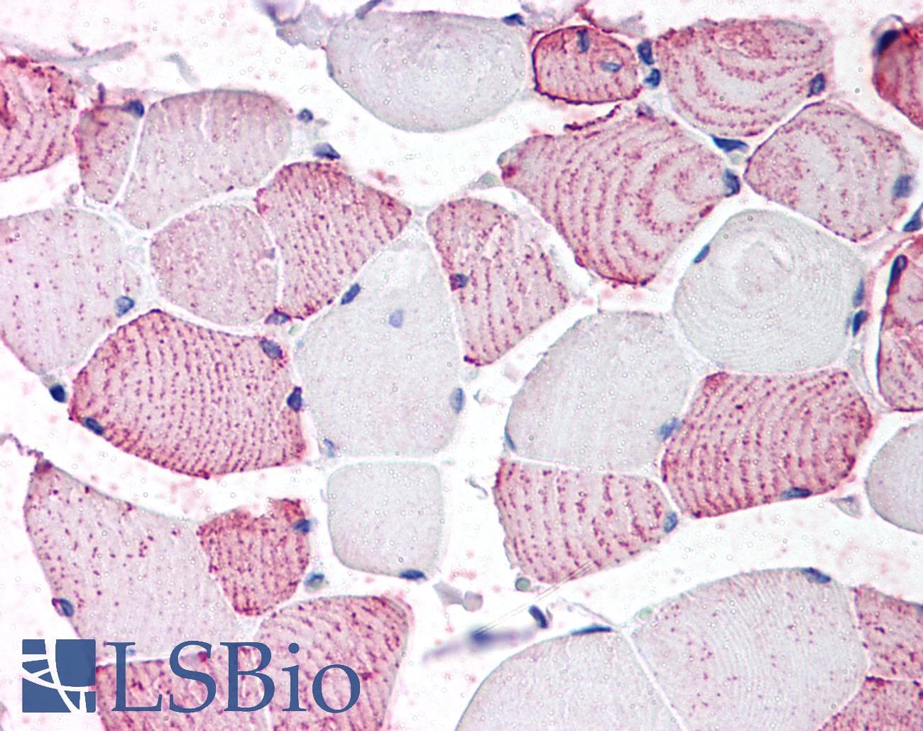 PathPlus™ Polyclonal Rabbit anti-Human GPRC6A Antibody (N-Terminus, IHC)