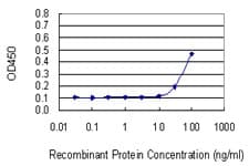 Monoclonal Mouse anti-Human PNP / Nucleoside Phosphorylase Antibody (clone 6E5, WB)