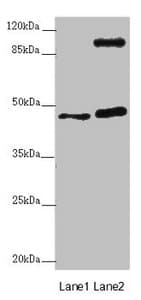 AURKA / Aurora-A Antibody (aa1-131)