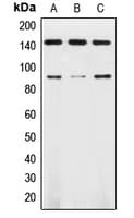 NTRK2 / TRKB Antibody (Internal)
