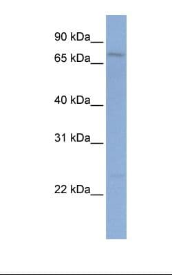 Polyclonal Rabbit anti-Human PCDHGB1 Antibody (aa182-231, WB)