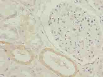 ZDHHC12 Antibody