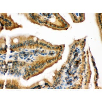 Polyclonal Rabbit anti-Human RAB13 Antibody (aa121-150, IHC, WB)