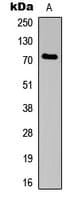 BCL6 Antibody (Internal)