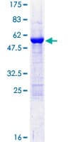 Human GT335 / ES1 Protein (Recombinant GST)