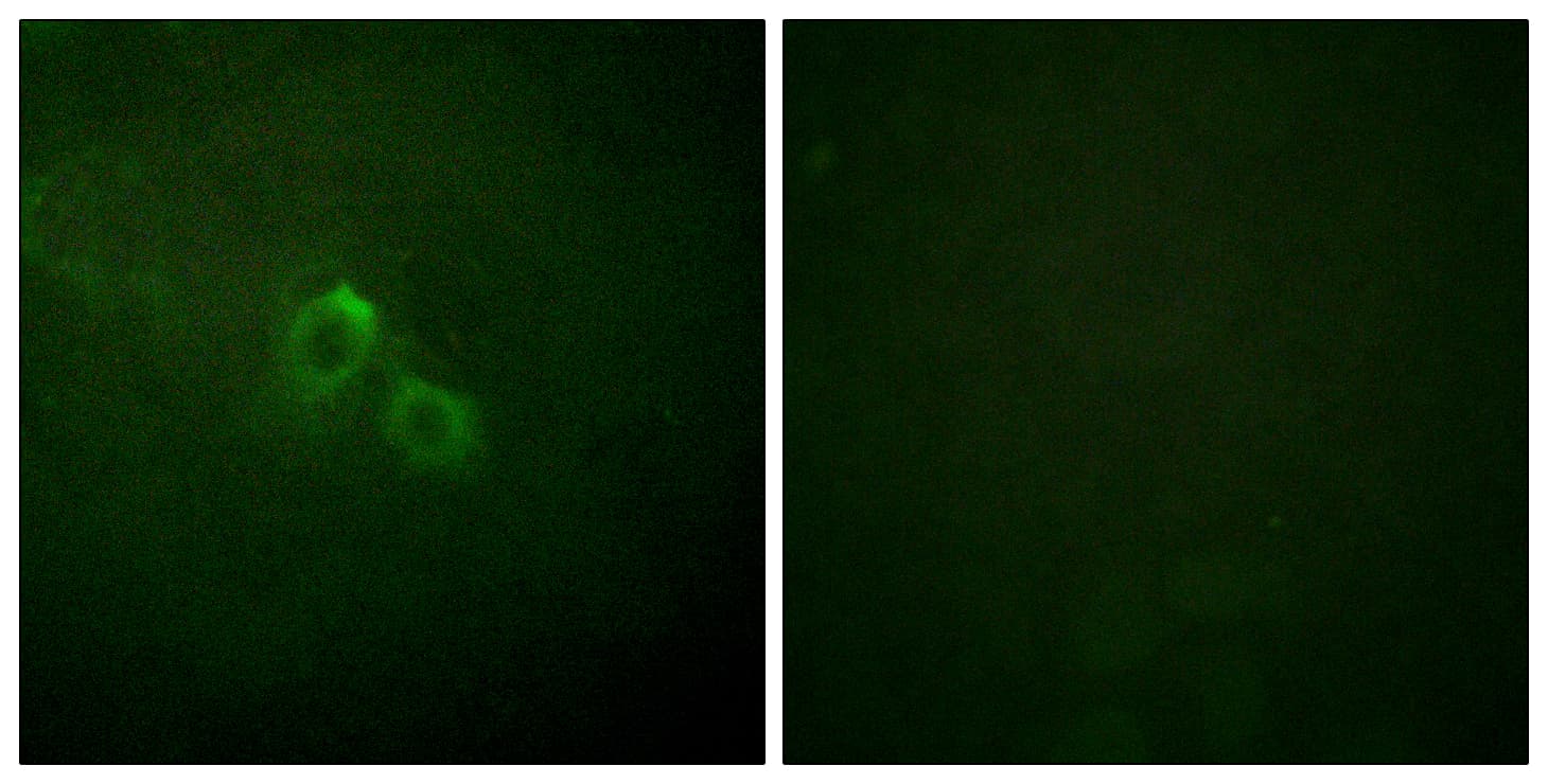 Polyclonal Rabbit anti-Human KCNA3 / Kv1.3 Antibody (aa101-150, IHC, IF)
