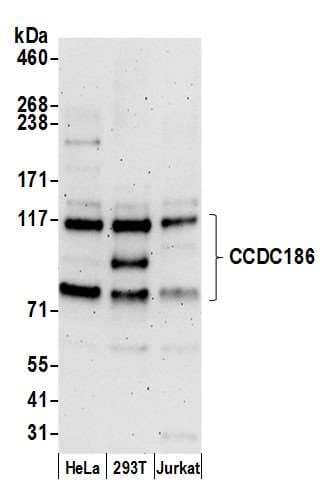 CCDC186 / C10orf118 Antibody (aa625-675)