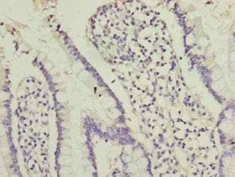 OOSP2 / PLAC1L Antibody