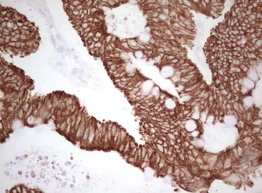 Basic Cytokeratin AE3 Antibody (clone AE3)